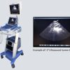 SonoSite Ultrasound