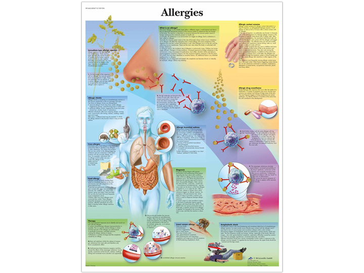 Anatomical Chart - Allergies