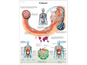 Anatomical Chart - Cancer - A-1 Medical Integration
