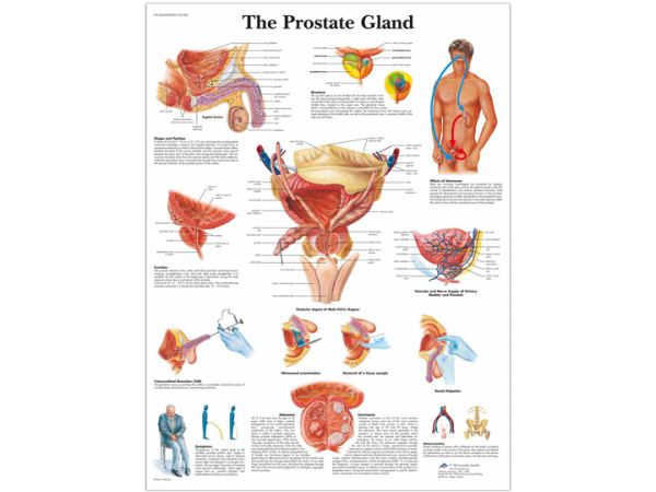 Anatomical Chart - Prostate Gland - A-1 Medical Integration