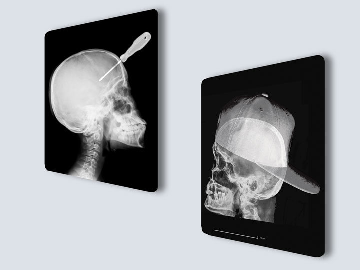 X-rays - Custom Film Prints