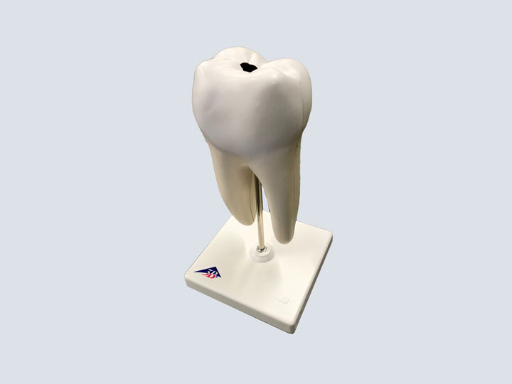 Model---Dental---Twin-Root-Molar-(w-Cavity)